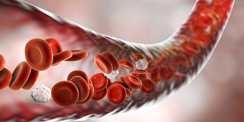 Blood vessel with flowing erythrocytes and leukocytes Chelation Therapy