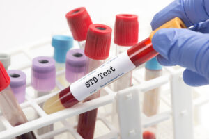 STD test blood analysis collection tube selected by technician.